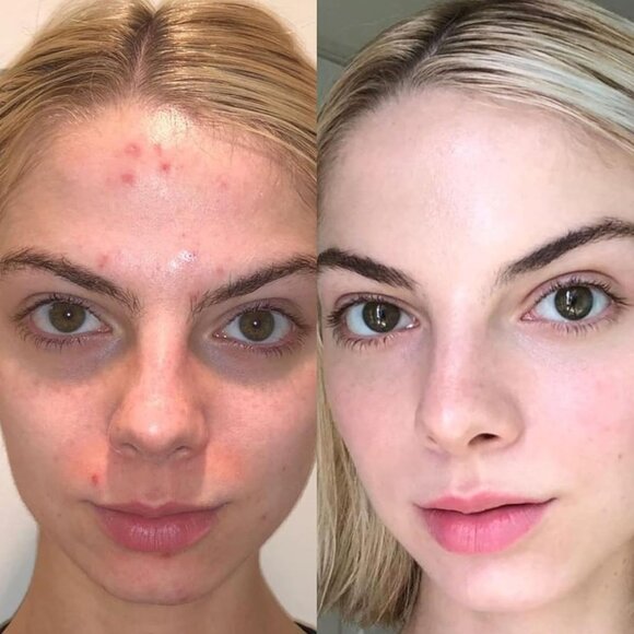 MARA - Natural Evening Primrose + Green Tea Algae Retinol Face Oil 15ml - Picture 4 of 6